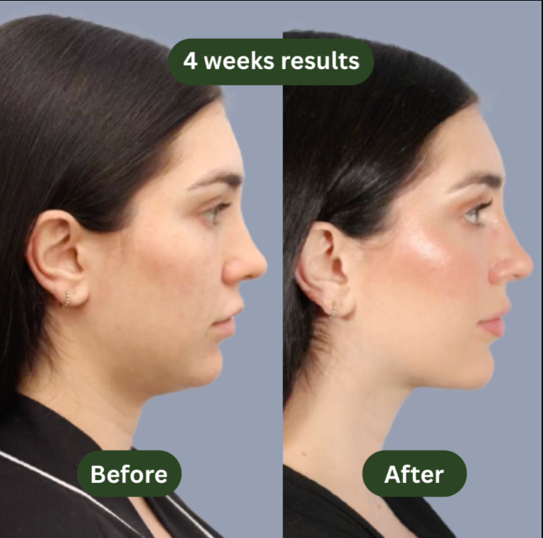 Nuveezy 17-in-1 Cortisol wellness Drops